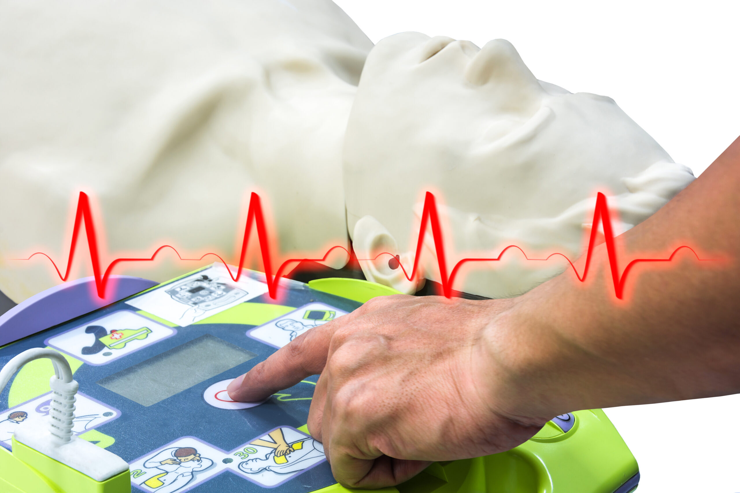 cropped-Zoll-ekg-scaled.jpeg